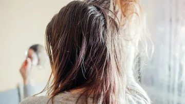 علت چربی پوست سر و راه های درمان آن