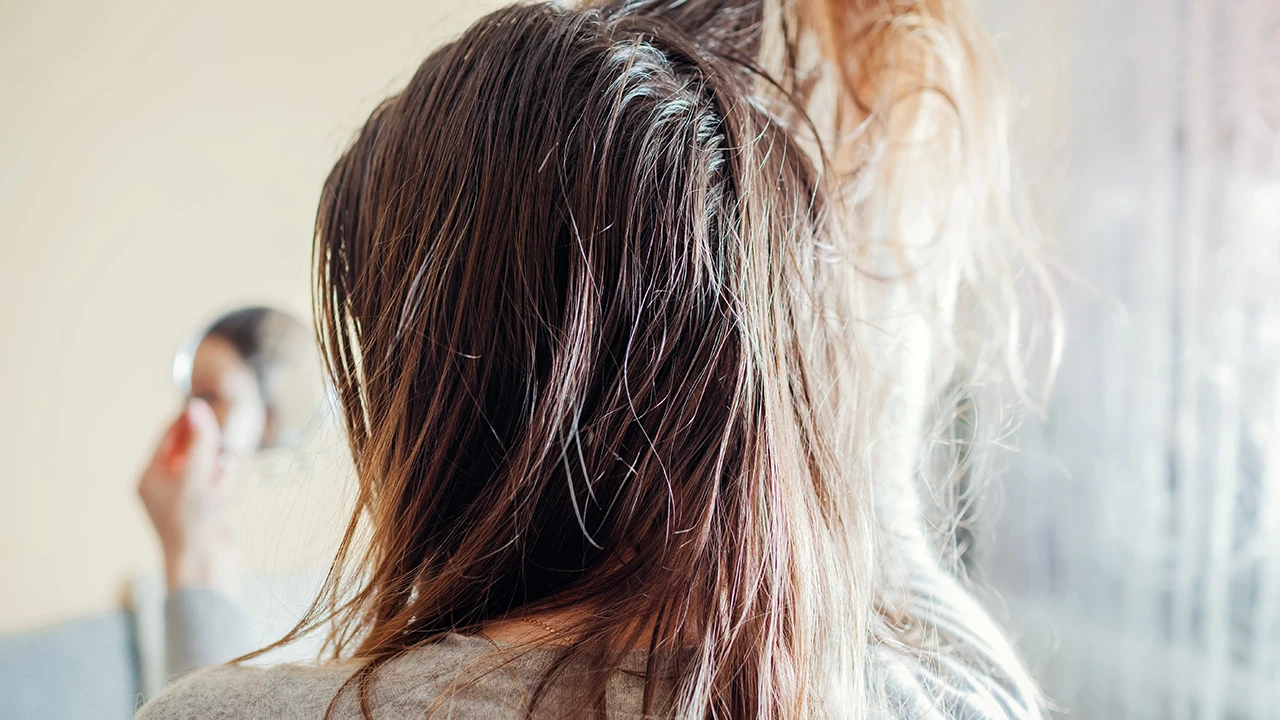 علت چربی پوست سر و راه های درمان آن