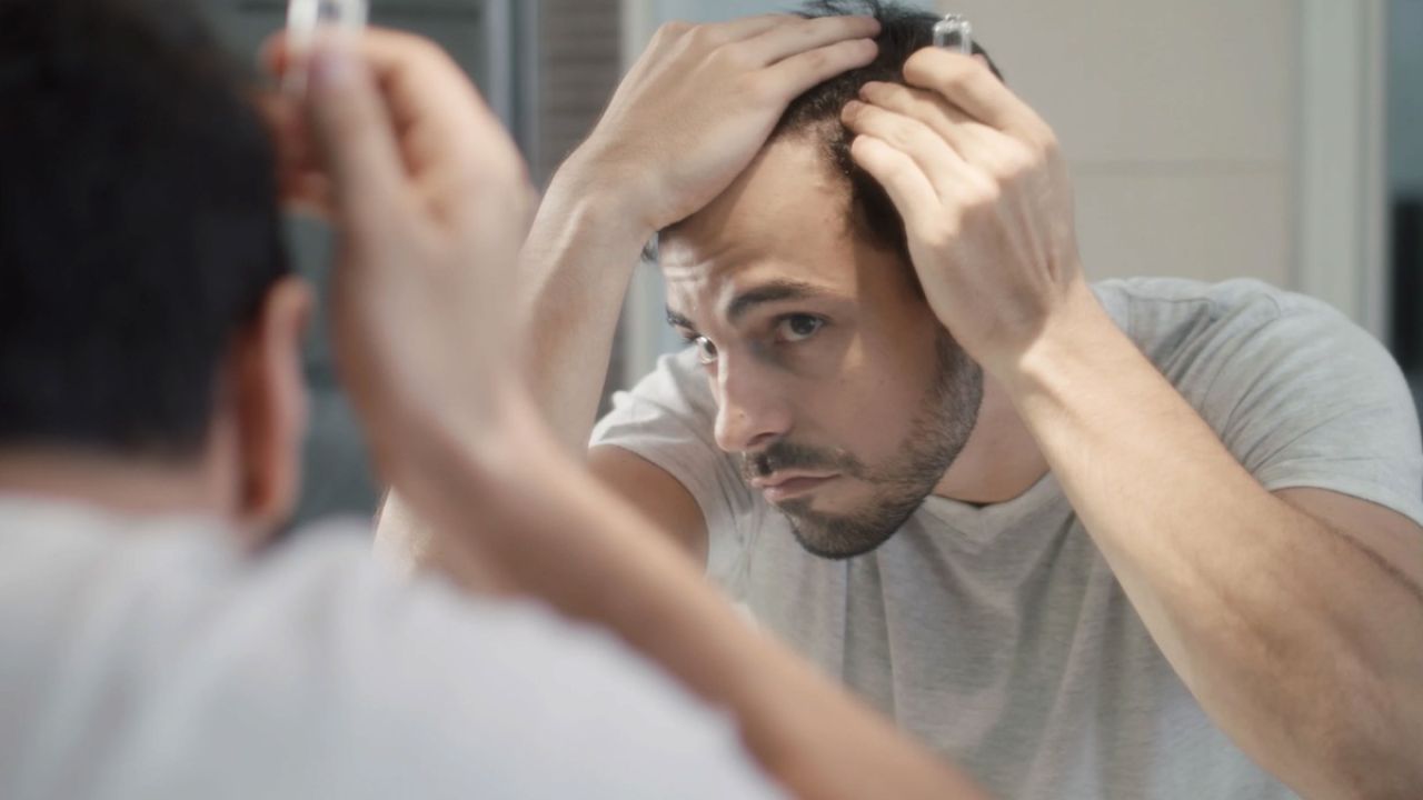 تأثیر محصولات طبیعی برای الوپسی آندروژنیک (ریزش مو) مردانه